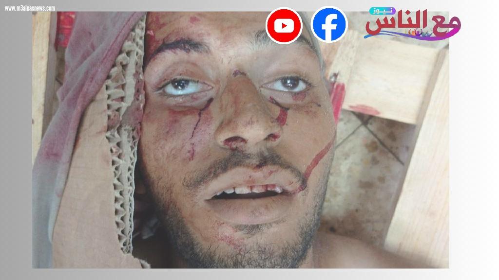 بالصور وصول شاب مجهول الهوية إلى مشرحة مجمع ناصر الطبى